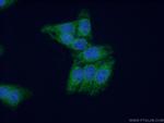 MPV17 Antibody in Immunocytochemistry (ICC/IF)