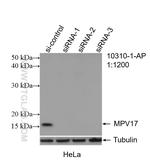 MPV17 Antibody in Western Blot (WB)