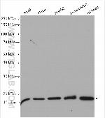 MPV17 Antibody in Western Blot (WB)