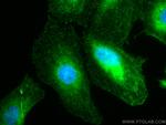 Stanniocalcin 2 Antibody in Immunocytochemistry (ICC/IF)