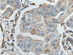 Stanniocalcin 2 Antibody in Immunohistochemistry (Paraffin) (IHC (P))