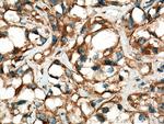 Stanniocalcin 2 Antibody in Immunohistochemistry (Paraffin) (IHC (P))