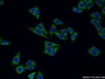 Cathepsin H Antibody in Immunocytochemistry (ICC/IF)