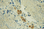 Cathepsin H Antibody in Immunohistochemistry (Paraffin) (IHC (P))