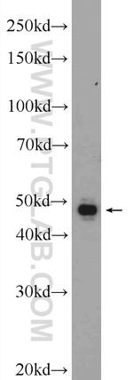 Cathepsin H Antibody in Western Blot (WB)