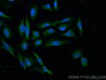 CRMP1 Antibody in Immunocytochemistry (ICC/IF)