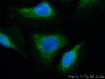 CRMP1 Antibody in Immunocytochemistry (ICC/IF)