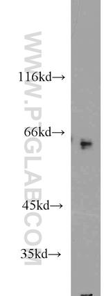 CRMP1 Antibody in Western Blot (WB)