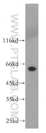 CRMP1 Antibody in Western Blot (WB)