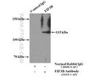 EIF3B Antibody in Immunoprecipitation (IP)