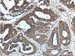 TCP1 Antibody in Immunohistochemistry (Paraffin) (IHC (P))