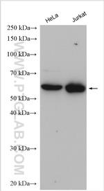 TCP1 Antibody in Western Blot (WB)