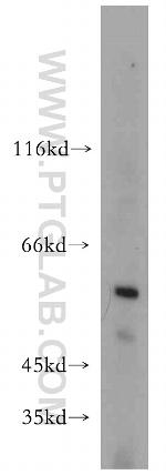 TCP1 Antibody in Western Blot (WB)