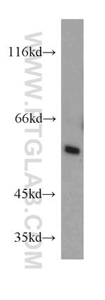 TCP1 Antibody in Western Blot (WB)