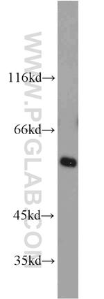 TCP1 Antibody in Western Blot (WB)