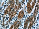 PPP2R4 Antibody in Immunohistochemistry (Paraffin) (IHC (P))