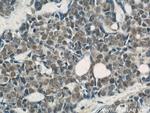 NUDT21 Antibody in Immunohistochemistry (Paraffin) (IHC (P))