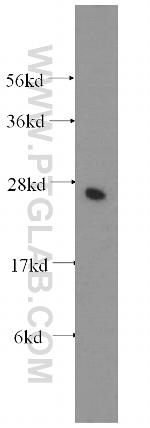 NUDT21 Antibody in Western Blot (WB)