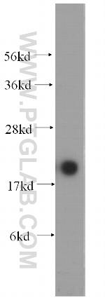 MYL12B Antibody in Western Blot (WB)