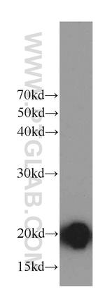 MYL12B Antibody in Western Blot (WB)