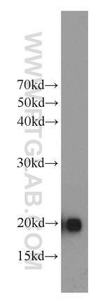 MYL12B Antibody in Western Blot (WB)