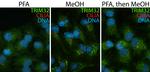 TRIM32 Antibody in Immunocytochemistry (ICC/IF)