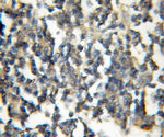 TRIM32 Antibody in Immunohistochemistry (Paraffin) (IHC (P))