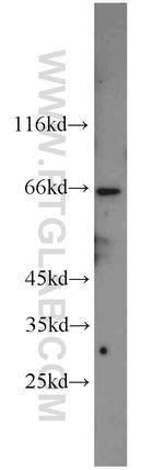 NXF1 Antibody in Western Blot (WB)