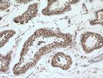 SUMO1 Antibody in Immunohistochemistry (Paraffin) (IHC (P))