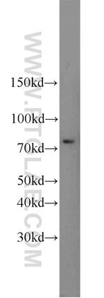 SUMO1 Antibody in Western Blot (WB)