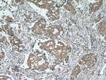 RARA Antibody in Immunohistochemistry (Paraffin) (IHC (P))