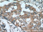 RARA Antibody in Immunohistochemistry (Paraffin) (IHC (P))