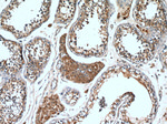 RARA Antibody in Immunohistochemistry (Paraffin) (IHC (P))