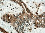 RARA Antibody in Immunohistochemistry (Paraffin) (IHC (P))