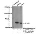 RARA Antibody in Immunoprecipitation (IP)