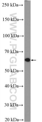 RARA Antibody in Western Blot (WB)