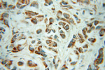 CHRNA3 Antibody in Immunohistochemistry (Paraffin) (IHC (P))