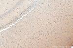 CHRNA3 Antibody in Immunohistochemistry (Paraffin) (IHC (P))