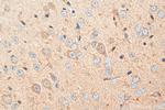 CHRNA3 Antibody in Immunohistochemistry (Paraffin) (IHC (P))