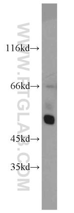 CHRNA3 Antibody in Western Blot (WB)