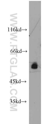 CHRNA3 Antibody in Western Blot (WB)