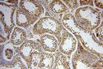 PAX8 Antibody in Immunohistochemistry (Paraffin) (IHC (P))