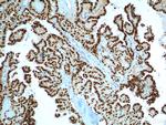 PAX8 Antibody in Immunohistochemistry (Paraffin) (IHC (P))