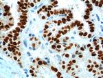 PAX8 Antibody in Immunohistochemistry (Paraffin) (IHC (P))