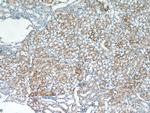 PAX8 Antibody in Immunohistochemistry (Paraffin) (IHC (P))