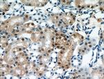 PAX8 Antibody in Immunohistochemistry (Paraffin) (IHC (P))