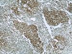 PAX8 Antibody in Immunohistochemistry (Paraffin) (IHC (P))