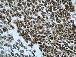 PAX8 Antibody in Immunohistochemistry (Paraffin) (IHC (P))