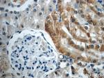 PAX8 Antibody in Immunohistochemistry (Paraffin) (IHC (P))