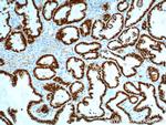 PAX8 Antibody in Immunohistochemistry (Paraffin) (IHC (P))